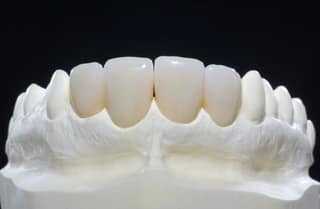 Convention collective 3254 prothesiste dentaire 02 image