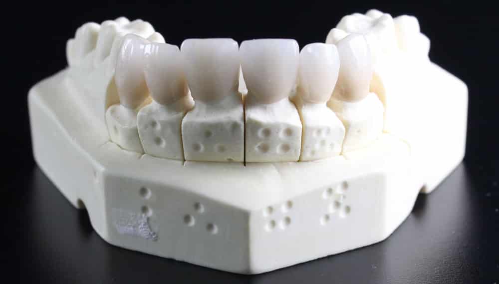 Grille des salaires 2022 des prothésistes dentaires