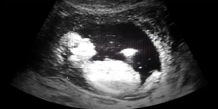 Formulaire officiel pour le premier examen médical prénatal