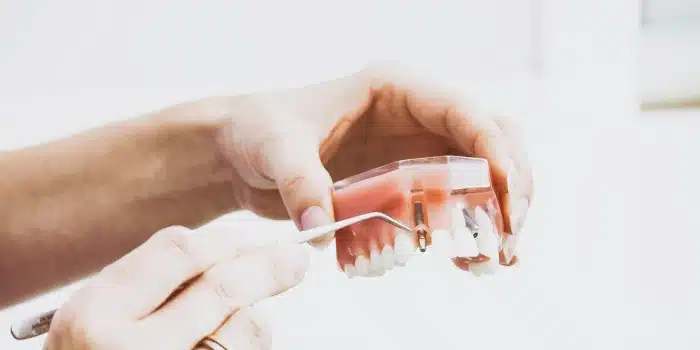 Rémunérations minimales des apprentis prothésistes dentaires en 2026
